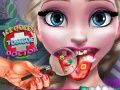 Spiel Eisprinzessin Zungenarzt Online