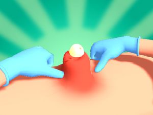 Spiel Pickelquetschern Online