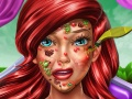 Spiel Hautarzt der Prinzessin Meerjungfrau Online